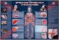 Электрифицированный стенд "Вредные привычки: алкоголизм" - fgospostavki.ru - Балахна