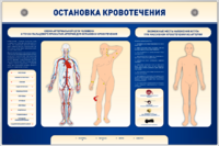 Электрифицированный стенд-тренажер "Остановка кровотечения" - fgospostavki.ru - Балахна