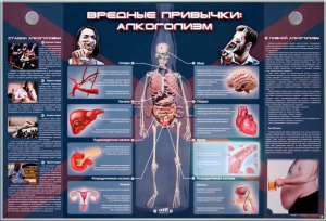 Электрифицированный стенд "Вредные привычки: алкоголизм" - fgospostavki.ru - Балахна